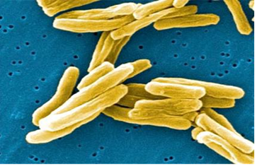 Mycobacterium tuberculosis – původce TBC v elektronovém mikroskopu